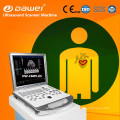 CE ISO approuvé matériel médical Plus15 pouces couleur doppler scanner à ultrasons et effacer l&#39;image portable portable couleur doppler 3D